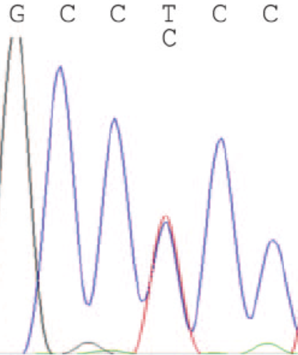Screenshot of DNA sequence electropherogram showing signature of peak under peak suggesting recombination.